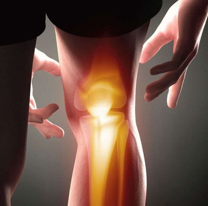 Wat ass Arthritis an Arthrosis